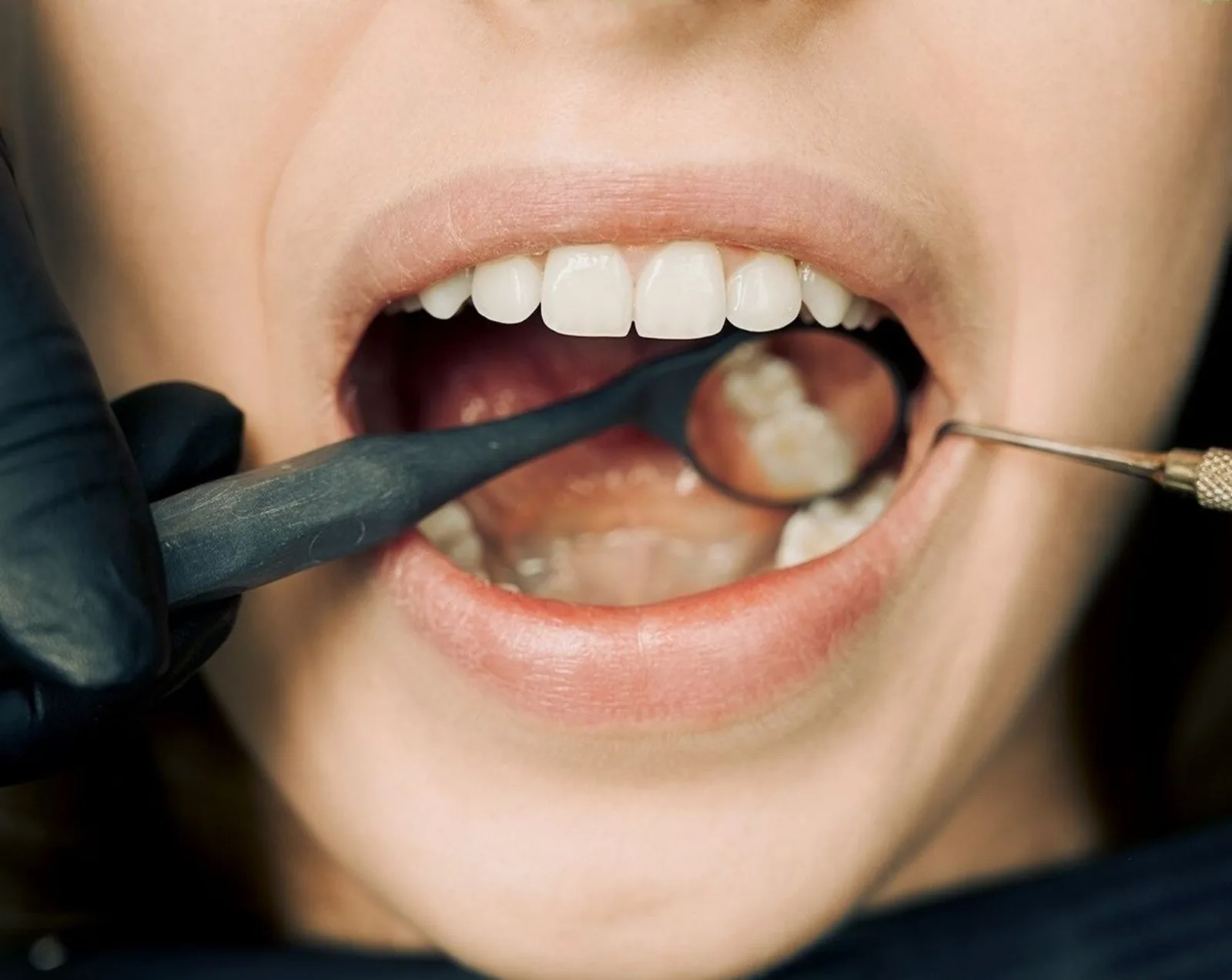 dentiste Genève