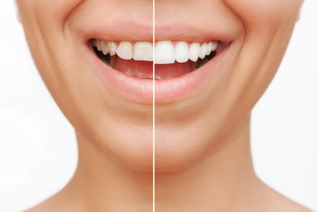 Smile Concept : une innovation Geneva Dental Clinic