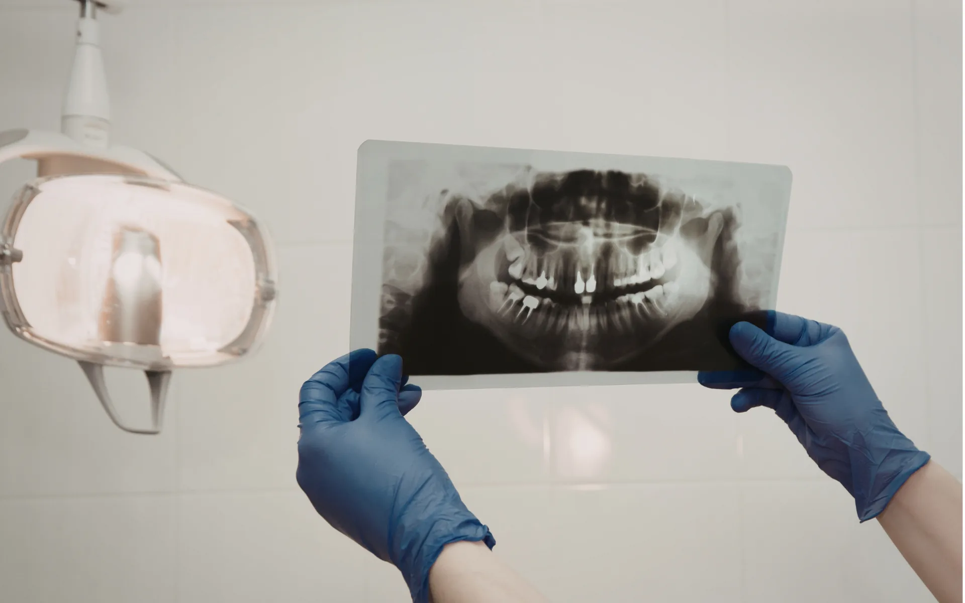 Lecture d’une radiographie panoramique des mâchoires devant le scialytique du cabinet