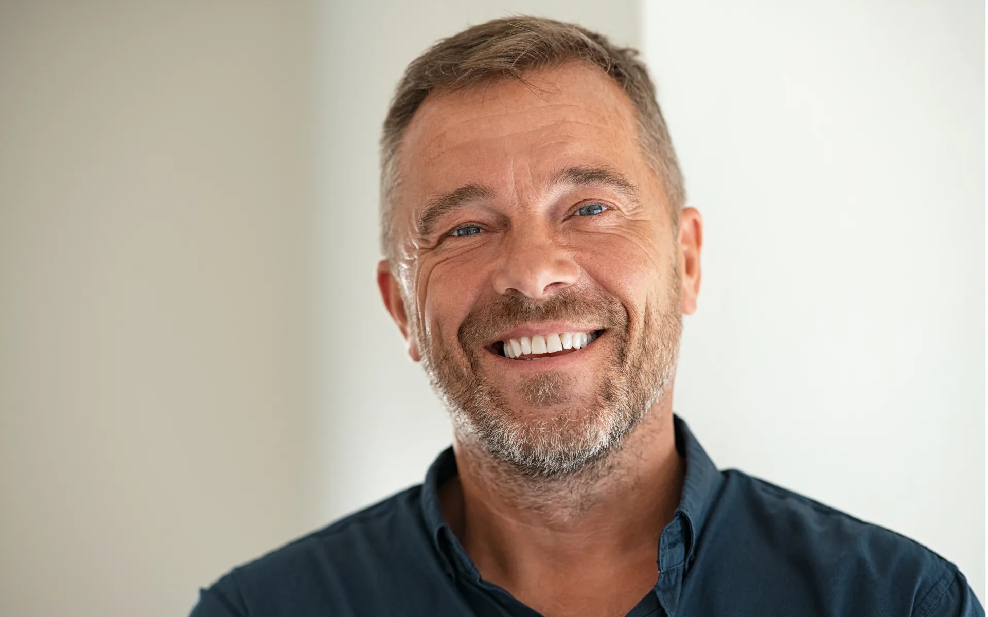 Teintier dentaire comparé au sourire d’une patiente avant un blanchiment